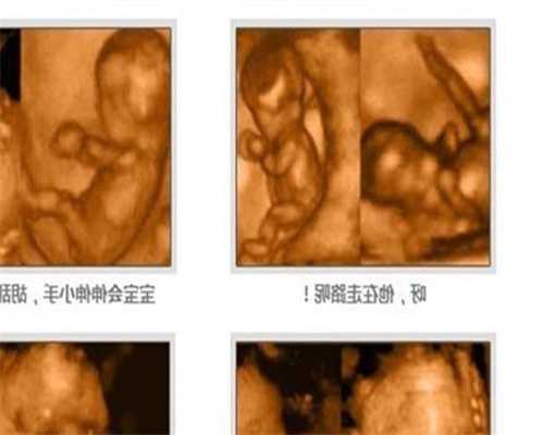 武汉代孕怎么联系：武汉代孕双胞胎的公司_武汉