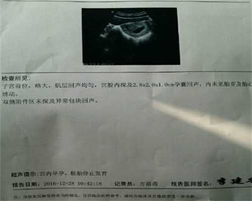 武汉代怀孩子：武汉2020年代怀孕价格_武汉代孕正