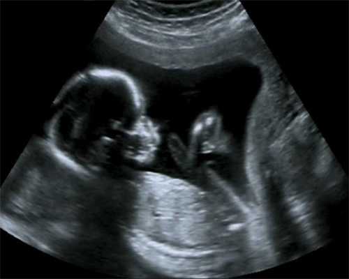 武汉代孕包双胞胎：武汉代孕有哪三种类型_武汉代孕后孩子